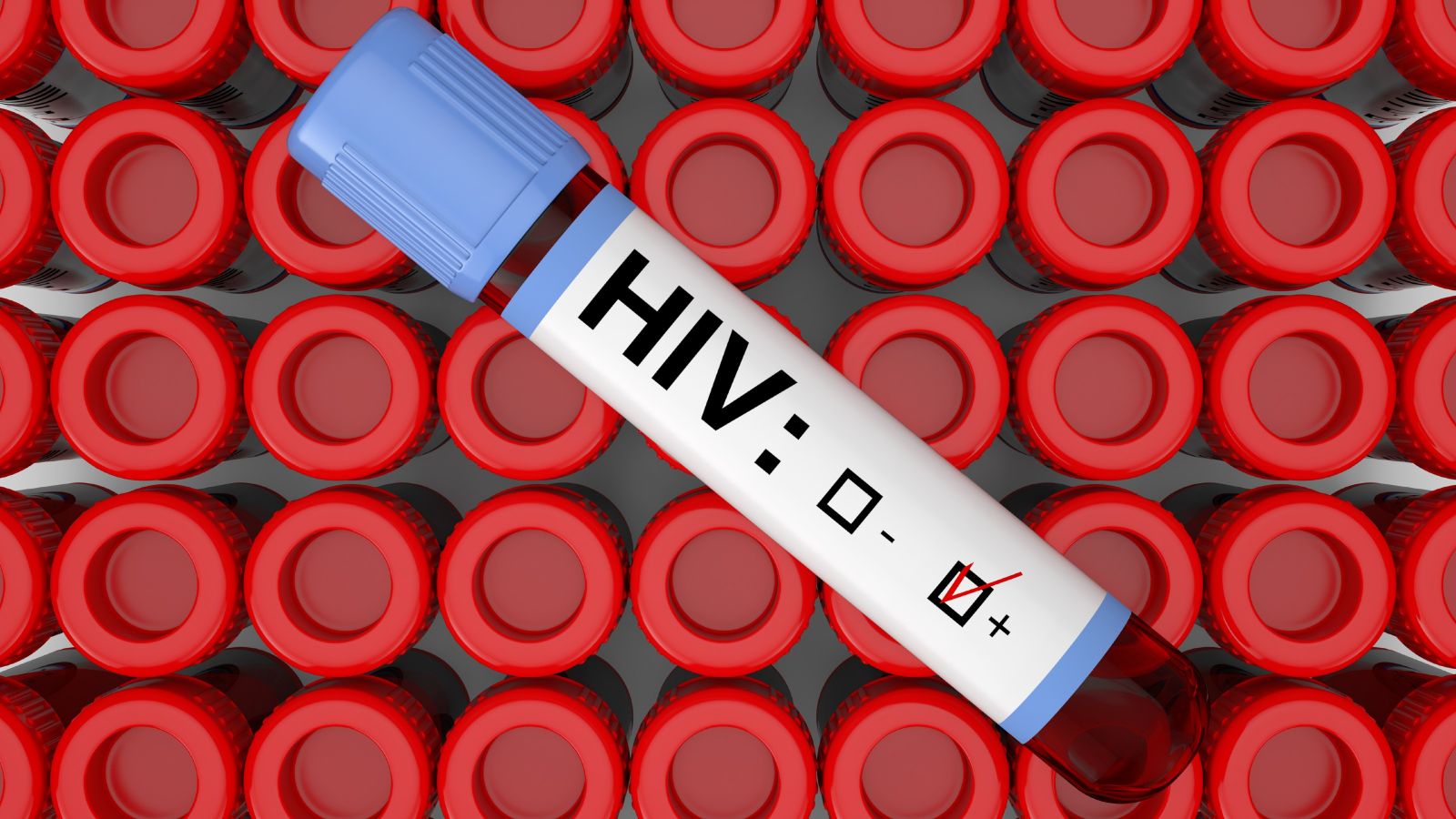 International Hiv Research To Improve Sexual And Reproductive Health Of Indigenous Women And